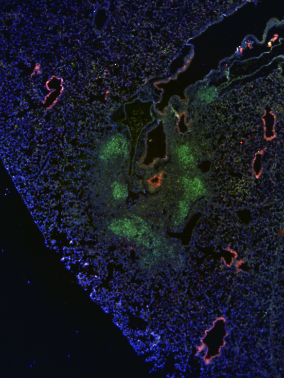 Internal view of a lung