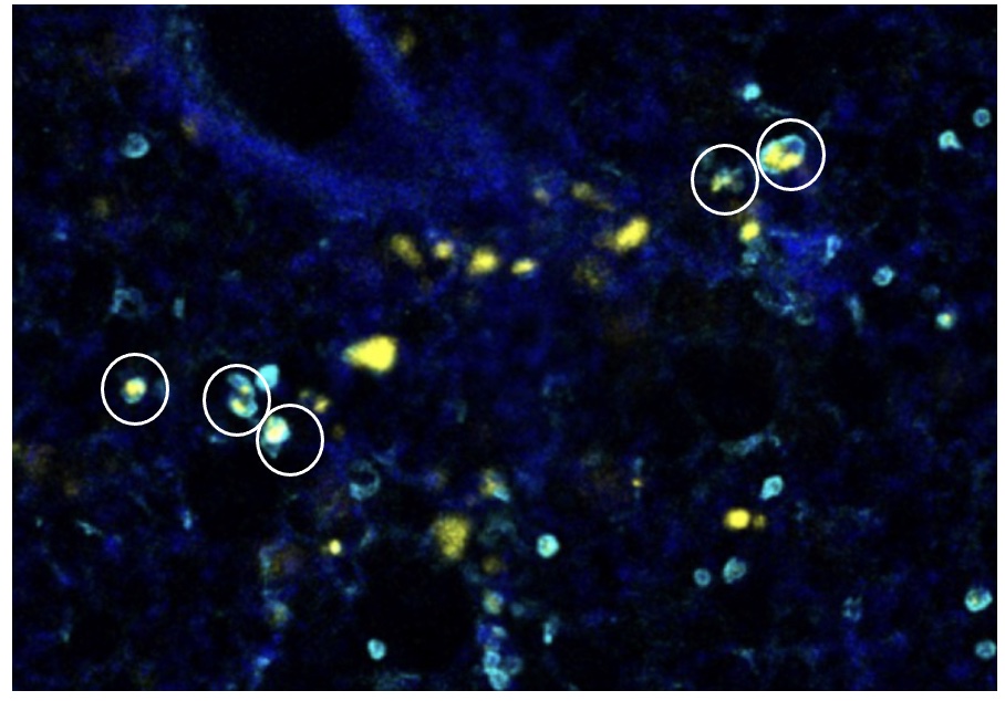 Internal view with Nanovax and DCs circled